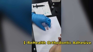 Sistema de unión de ortodoncia